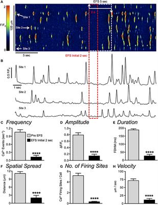 Inhibitory Neural Regulation of the Ca2+ Transients in Intramuscular Interstitial Cells of Cajal in the Small Intestine